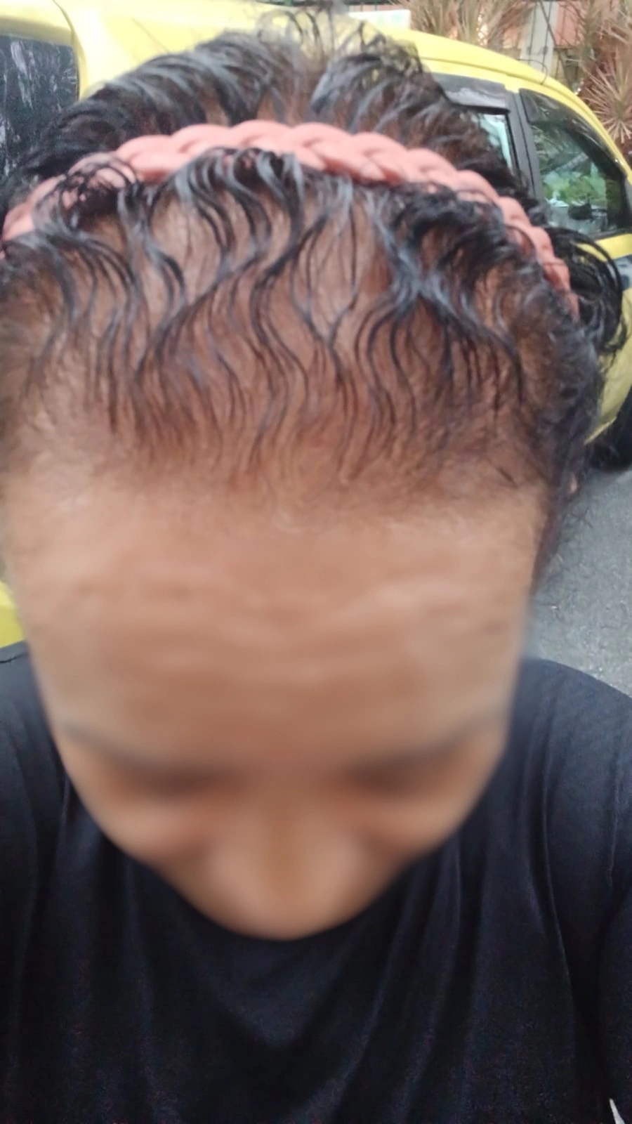 Antes do tratamento — cliente New Capelli