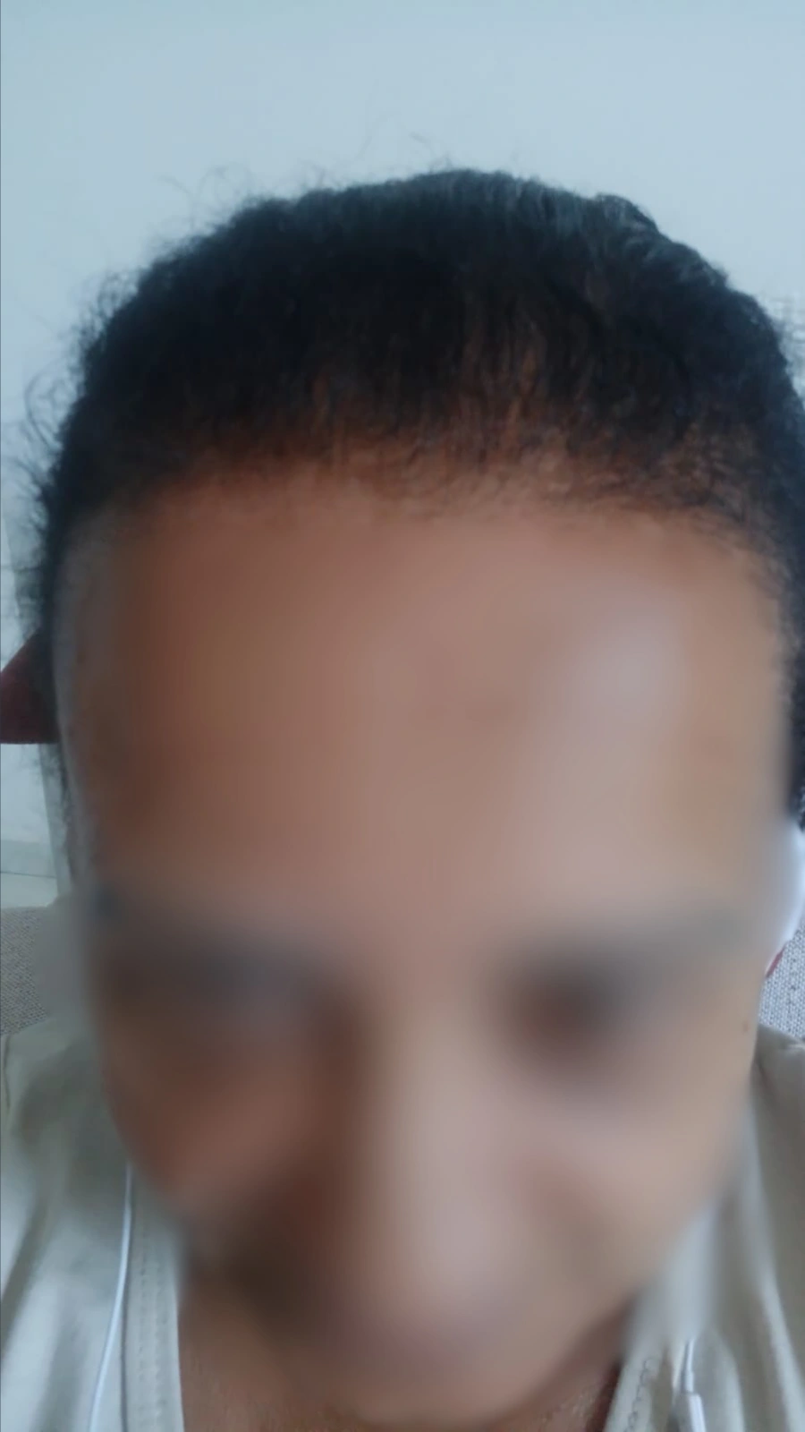Depois do tratamento — cliente New Capelli