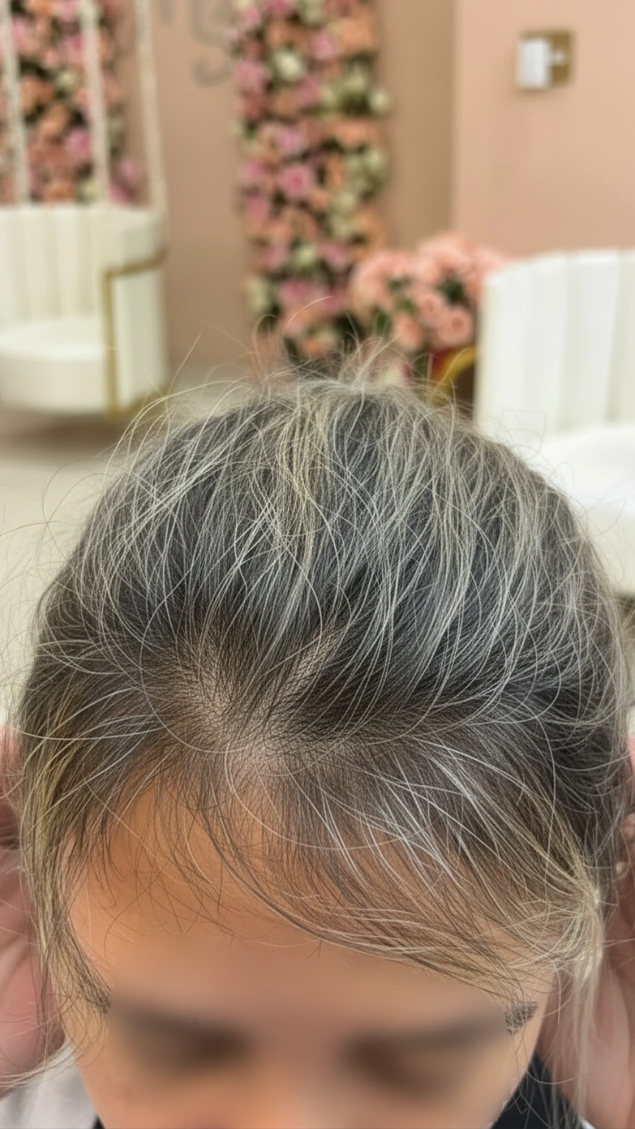 Antes do tratamento — cliente New Capelli