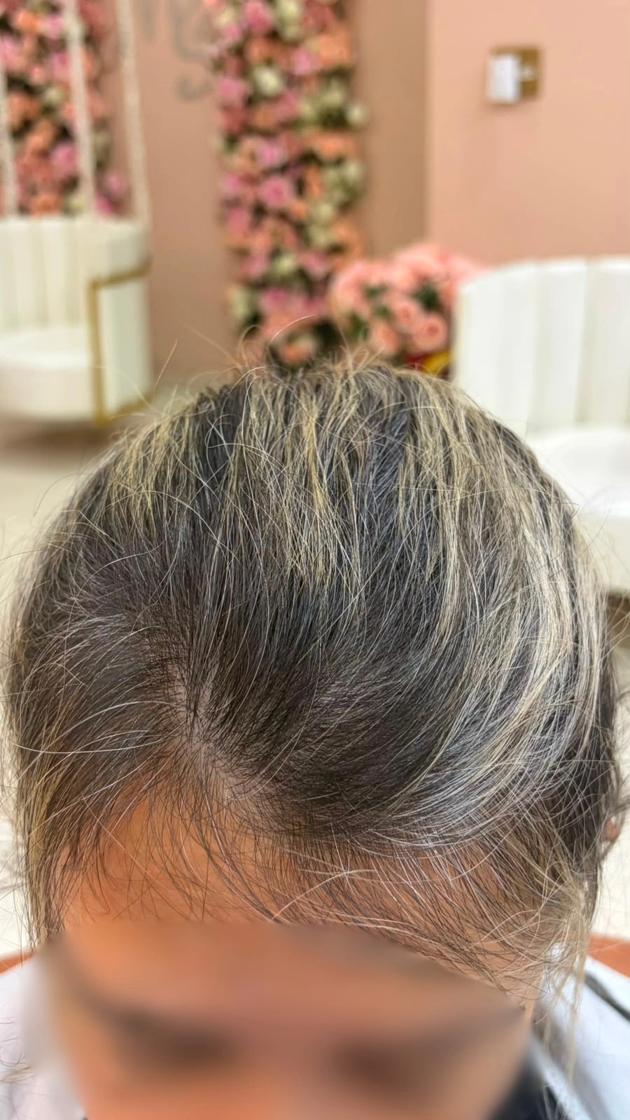 Depois do tratamento — cliente New Capelli